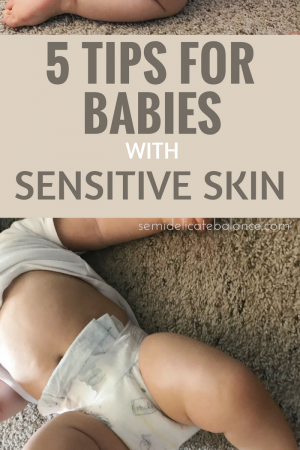 Tips for Babies with Sensitive Skin